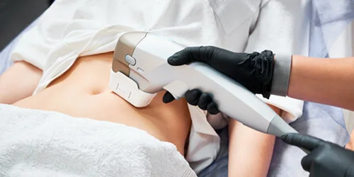 Hair Transplant in Pakistan, Karachi & Lahore